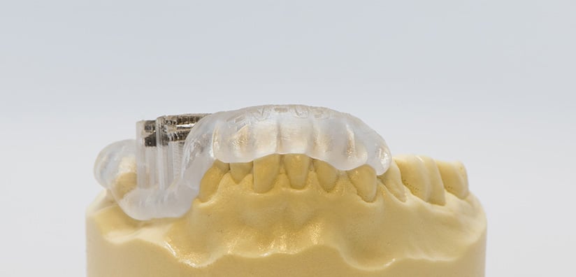 WHAT IS A SURGICAL GUIDE IN DENTISTRY visual data 3